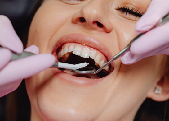 Comment se déroule le processus d’implantation dentaire ?